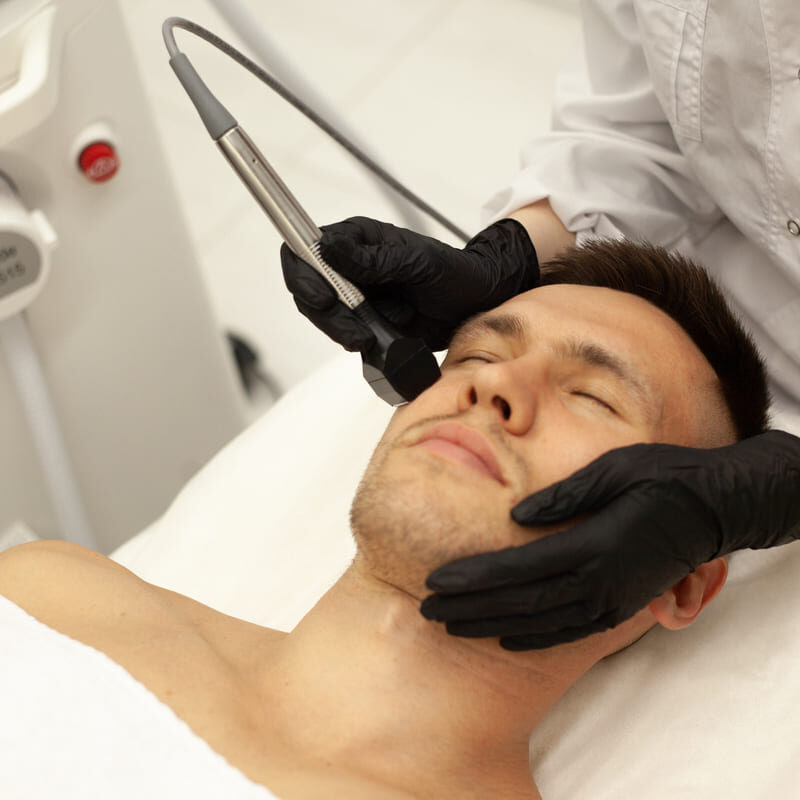 RF-лифтинг лица насадкой FORMA